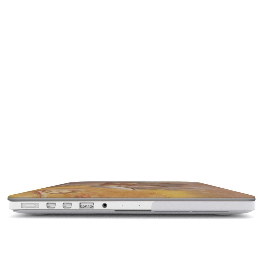 Cover MacBook ALBEMORA – Angeli Musicanti